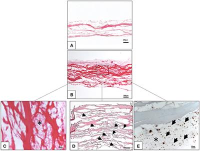 In vivo Implantation of a Bovine-Derived Collagen Membrane Leads to Changes in the Physiological Cellular Pattern of Wound Healing by the Induction of Multinucleated Giant Cells: An Adverse Reaction?